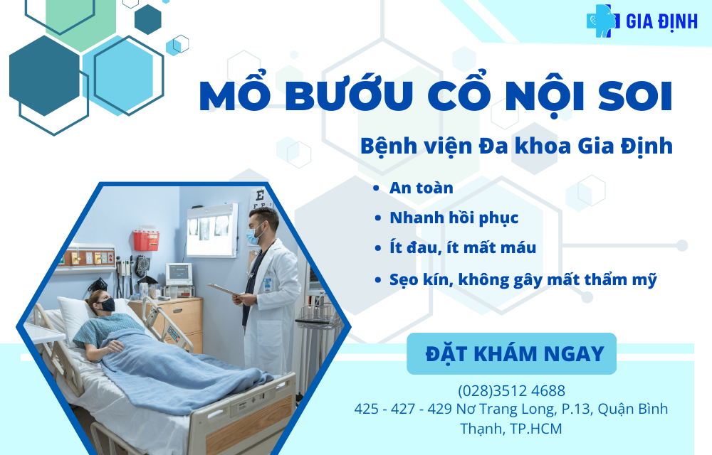 mổ bướu cổ nội soi