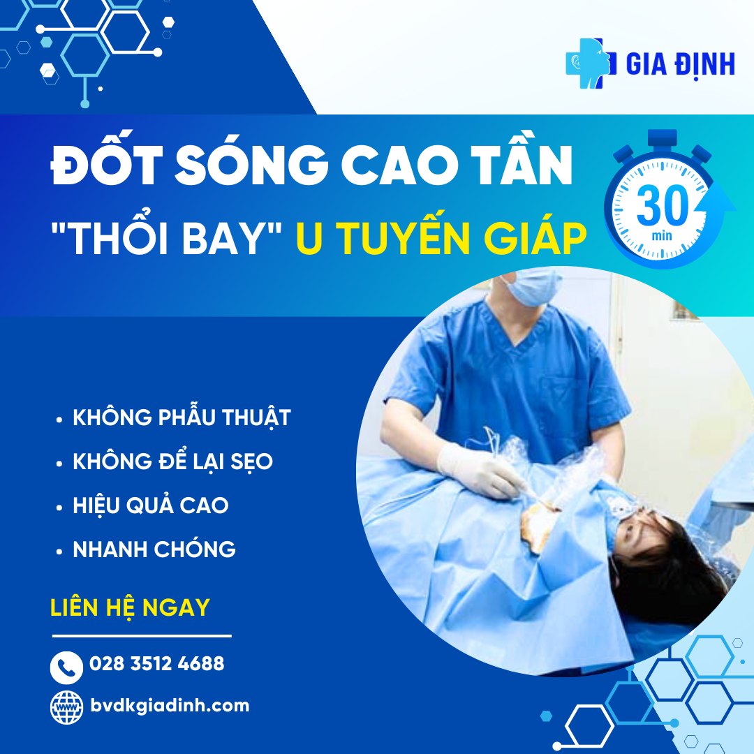 mổ bướu cổ - RFA