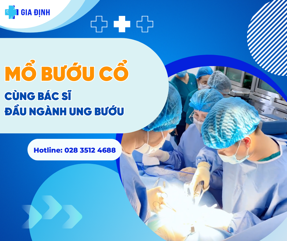 mổ bướu cổ