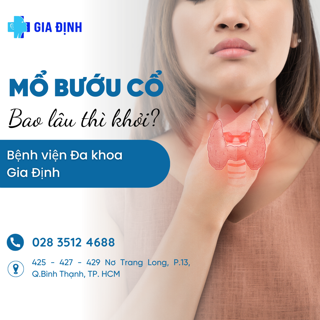 mổ bướu cổ