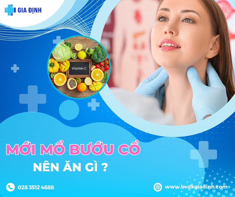 Mổ bướu cổ ăn gì