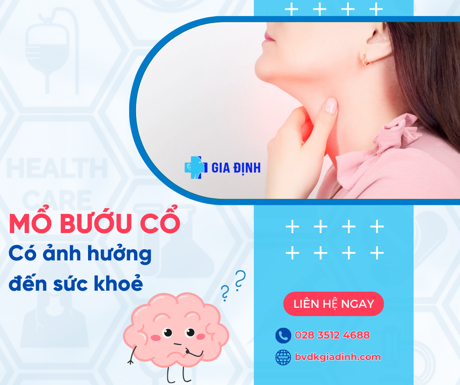 mổ bướu cổ