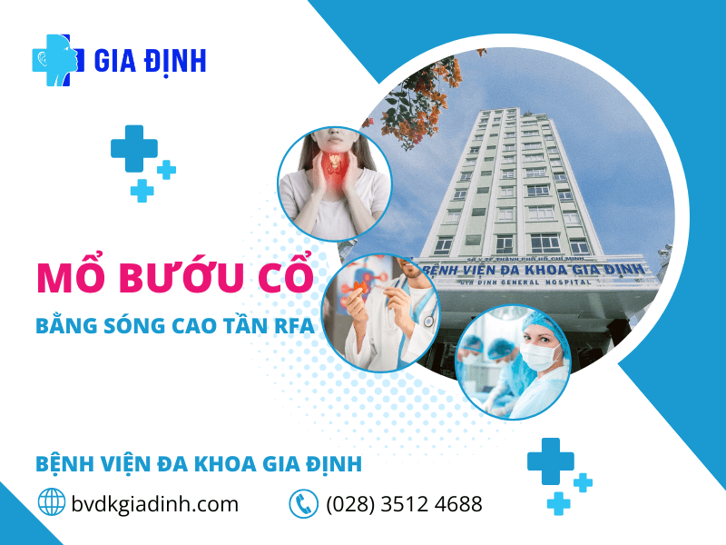 Mổ bướu cổ