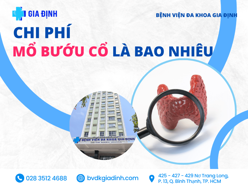 Chi phí mổ Bướu cổ