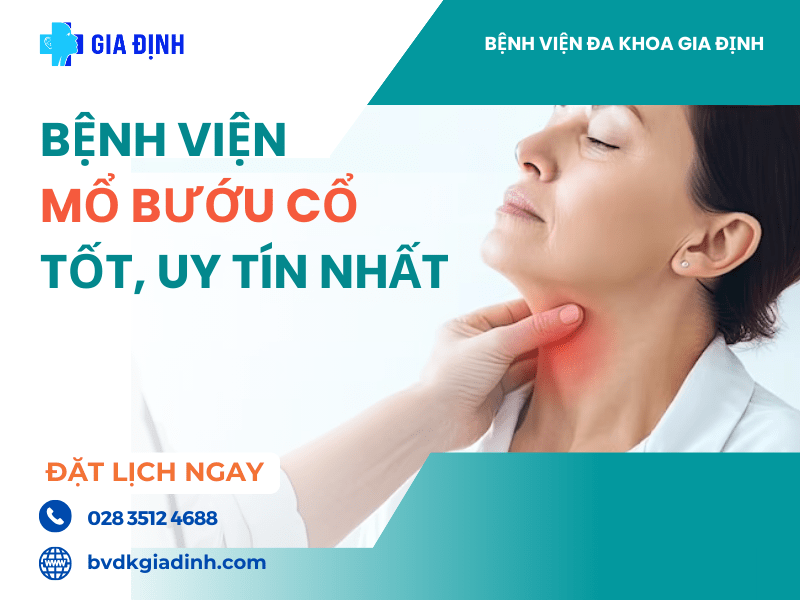 Địa chỉ mổ bướu cổ uy tín