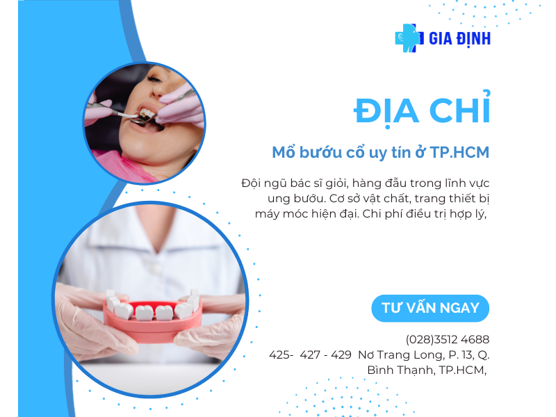 địa chỉ mổ bướu cổ Sài Gòn