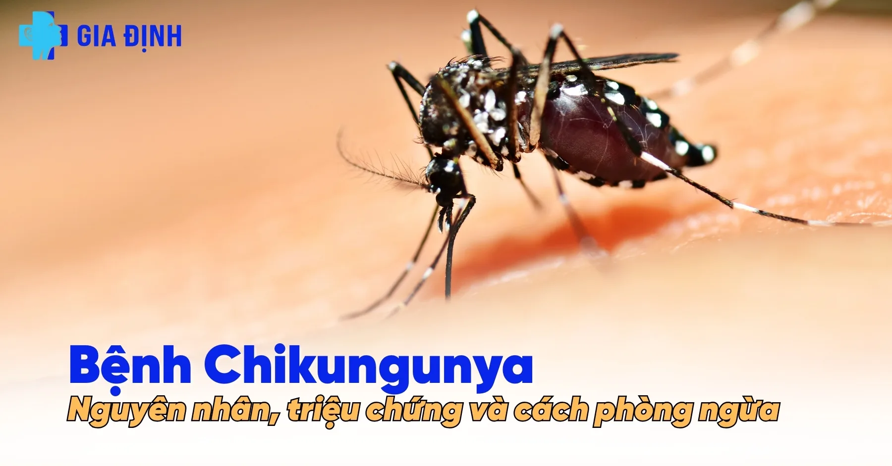 avt Bệnh Chikungunya