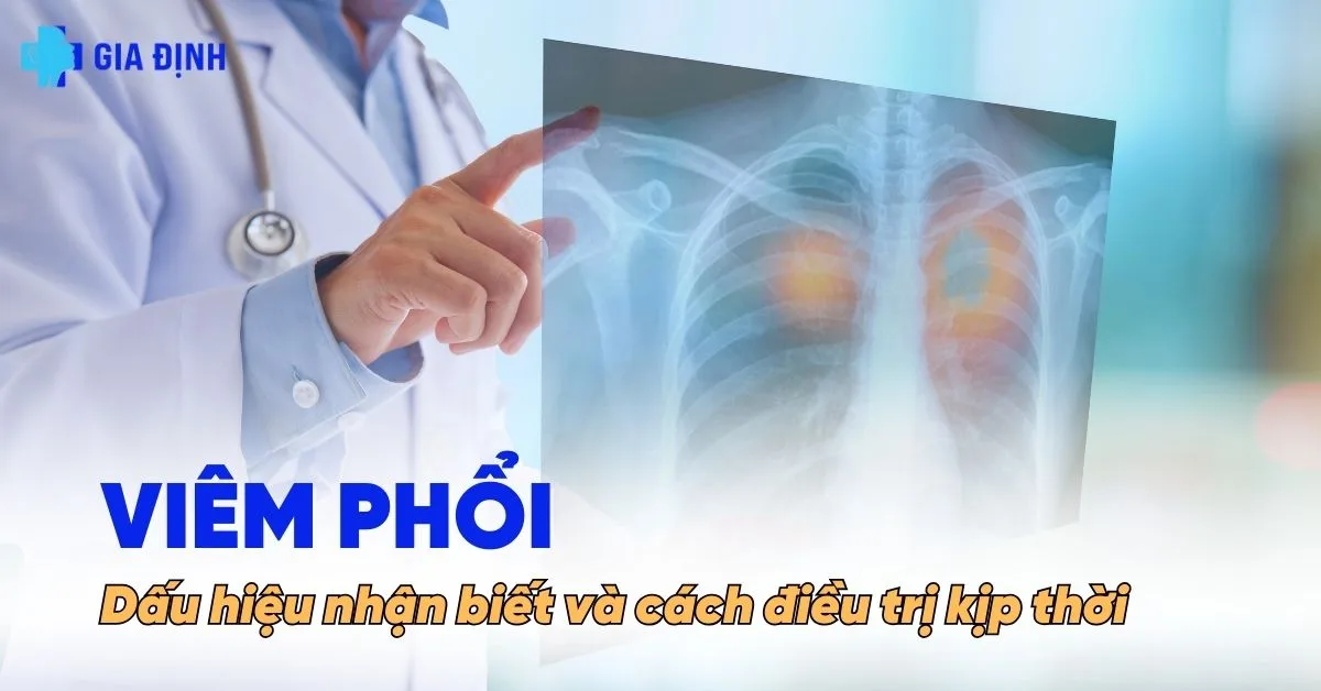 avt viêm phổi