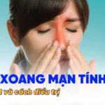 avt viêm xoang mạn tính