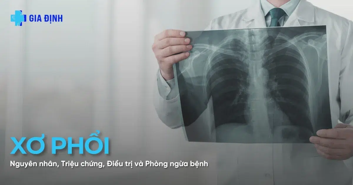 Bệnh xơ phổi